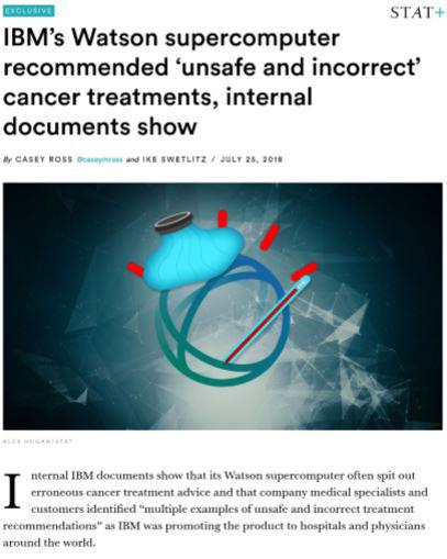 IBM watson supercomputer recommended unsafe and incorrect cancer treatments